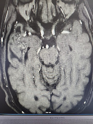 Photo n°6 de ccmn-neurologie à Orsay (Neurologue)