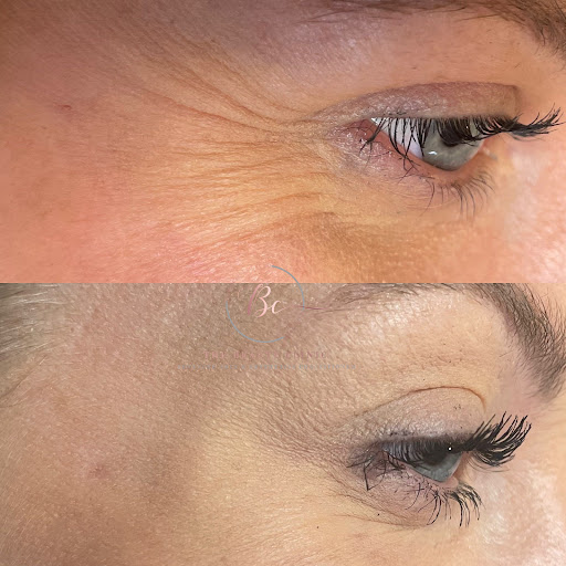 The Beauty Clinic -Skin Clinic