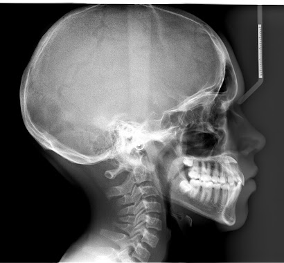 KRANEX CENTRO DE TOMOGRAFIAS ODONTOLOGICAS, Author: KRANEX CENTRO DE TOMOGRAFIAS ODONTOLOGICAS