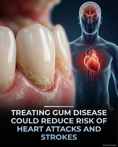 🦷 Gum Disease Treatment in Siliguri | Healthy Gums, Healthy Smile! post image