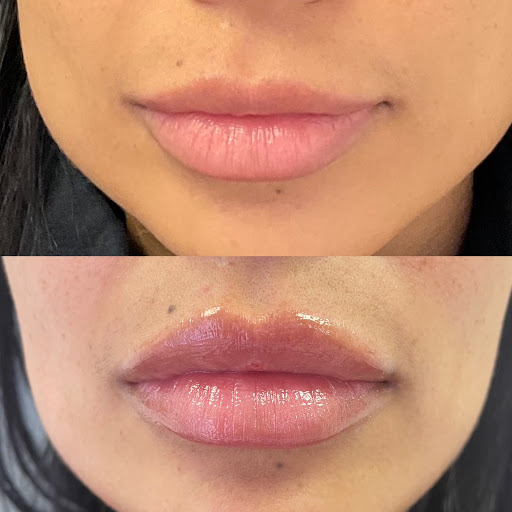 Yunik Aesthetics Medspa