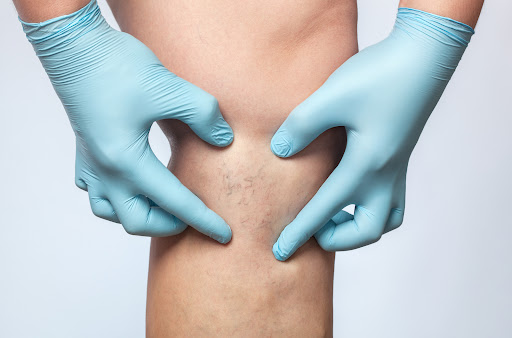Fisioterapia Lugano a Domicilio