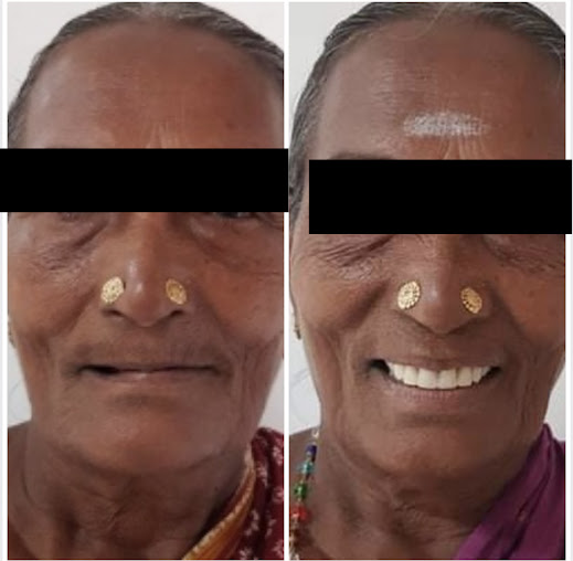 Af1qipob3gdf5xlx4tsejcbtp86zi3jsbzjihe1bunky=s519 K No