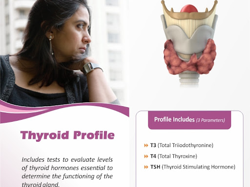Thyrocare Thyroid Test (T3-T4-TSH) Profile in Kanpur | 3 post image