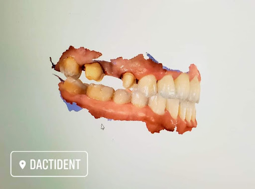 DactiDent Gallery - Mexico