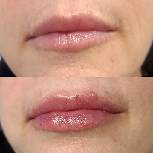 Labotox Med Spa