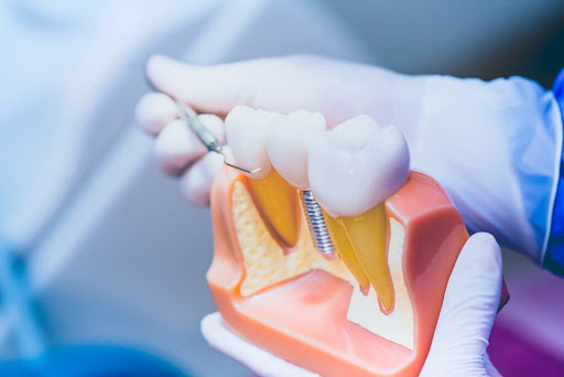 Studio Dentistico Panella - Thumbnail