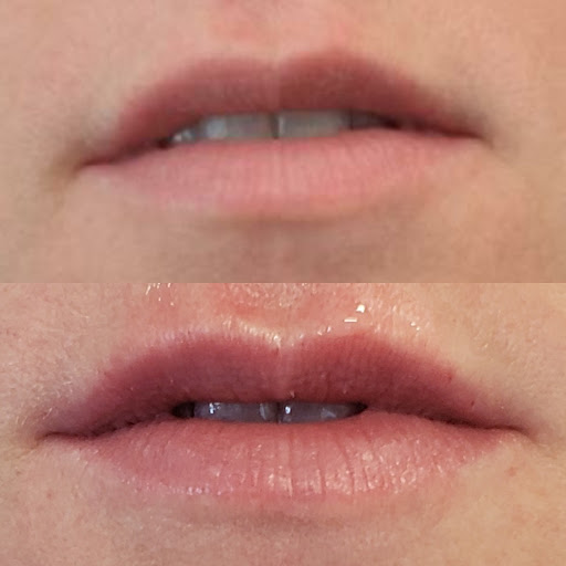 Temple Aesthetics and Wellness, PLLC