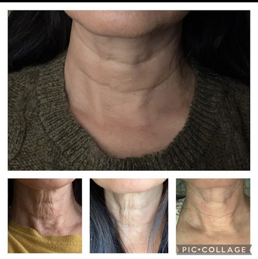 Clove Lakes Laser Center & Medical Spa - Thumbnail