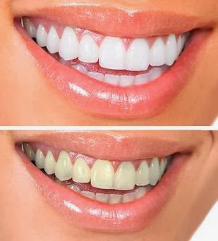Kipton Anderson, DDS - Thumbnail