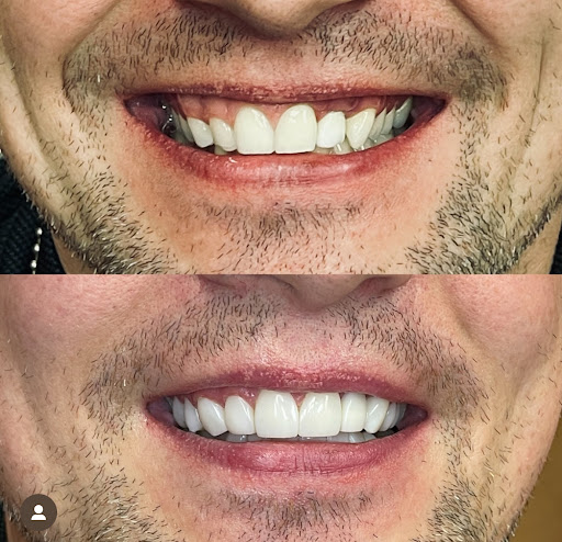 Bright & White Dental South Woodford - Thumbnail