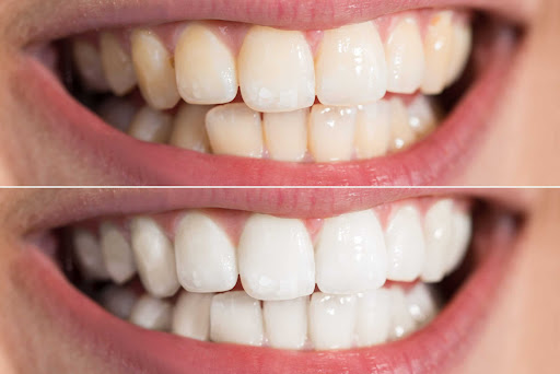 Smileology UK
