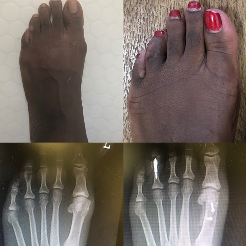London Foot & Ankle Surgery Phone number