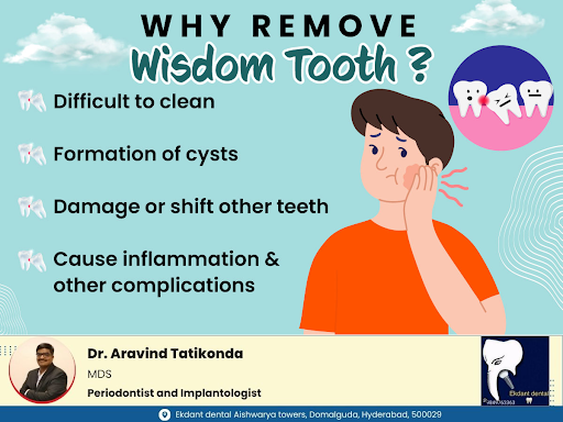 Why Remove Wisdom Tooth? post image