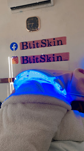 BlitSkin - Visual
