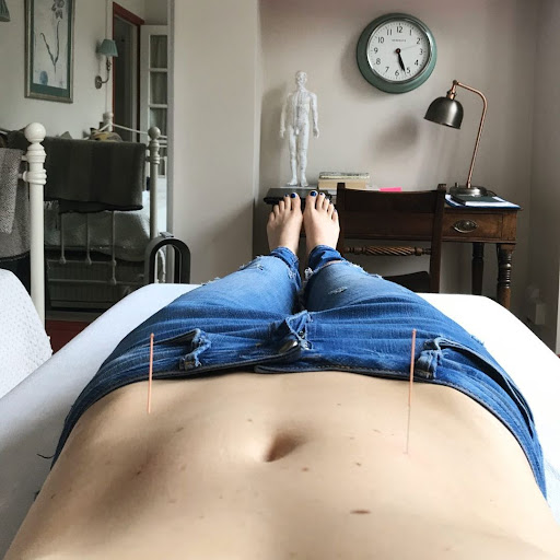 Laura Boscawen Acupuncture & Massage - BSc, BSc, LicAc, BTEC5, MBAcC - Thumbnail