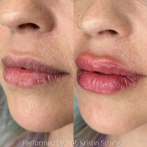 Monarch Beauty Aesthetics