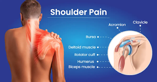Struggling with Shoulder Pain? Get Expert Care at Spineflex Physio & Sports Rehab in Vadodara
