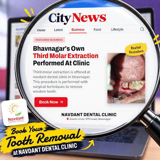 Navdant Dental Clinic in Bhavnagar offers expert third molar extraction using advanced surgical t… post image