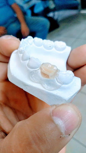 Dental Nissi - Thumbnail