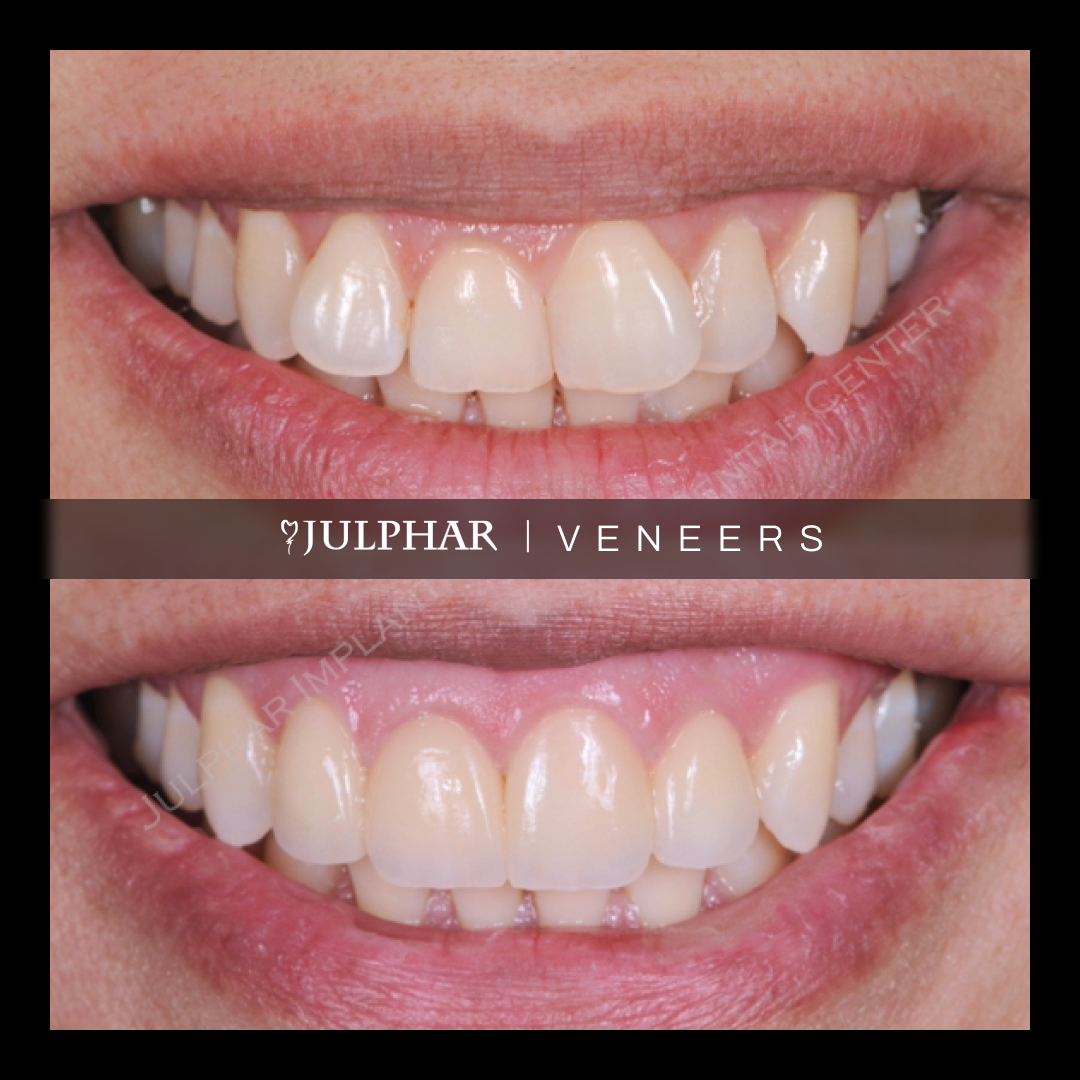 Julphar Implant & Cosmetic Dental Center - Julphar Tower Branch - صورة 3