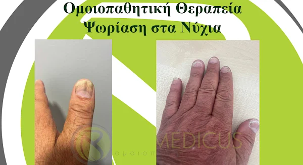 Κλινικό Αποτέλεσμα