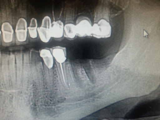 Affordable General Dentistry & Implants