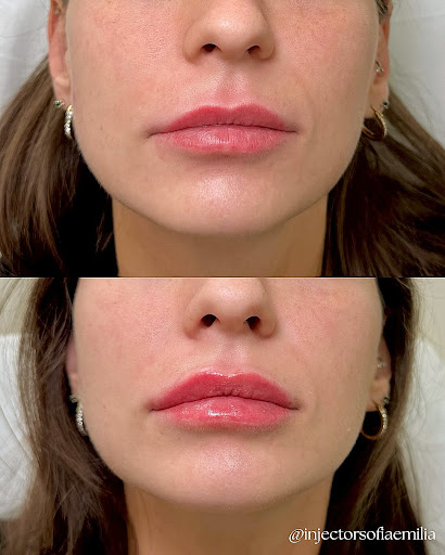 iBeauty Medspa: Center For Laser & Cosmetic Surgery