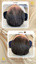 Photo n°26 de Centre Esthétique Laser Lille - Epilation laser - Médecine anti âge - Soin capillaire à Lille (Centre de bien-être)