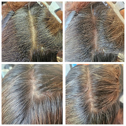 Photo n°4 de Poux and Co - Salon Anti-Poux à PAU (64) à Pau (Salon de coiffure)