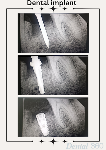 Gallery image 35
