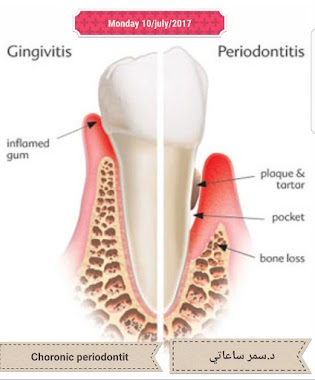 د.سمر ساعاتي، مركز صاري الحديث لطب الأسنان, Author: د.سمر ساعاتي، مركز صاري الحديث لطب الأسنان