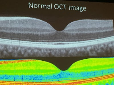 Photos of Optometrist in Findlay Ohio, Eyes on Main, Duane Wires,O.D. Liane Wilt, OD Sarah Wildermuth OD
