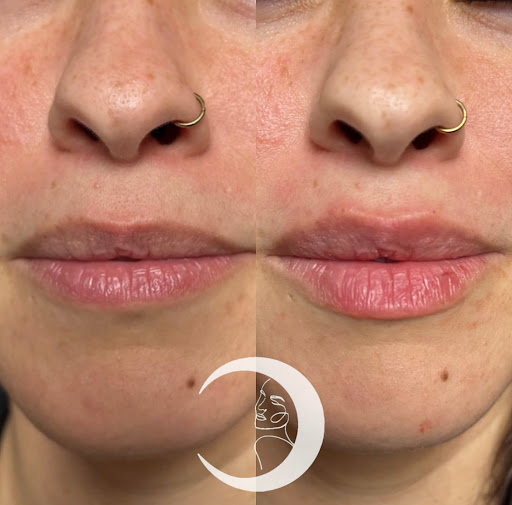 True Medical Aesthetics PLLC