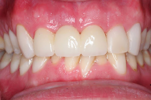 Tysons Dental Esthetics - Thumbnail