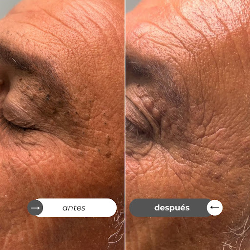 Centro de Depilación y Estética Oni Esthetic No+vello - Thumbnail