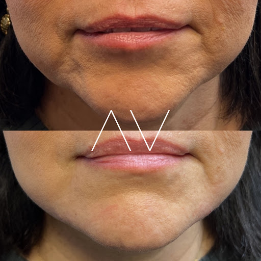 Avail Aesthetics - Asheville