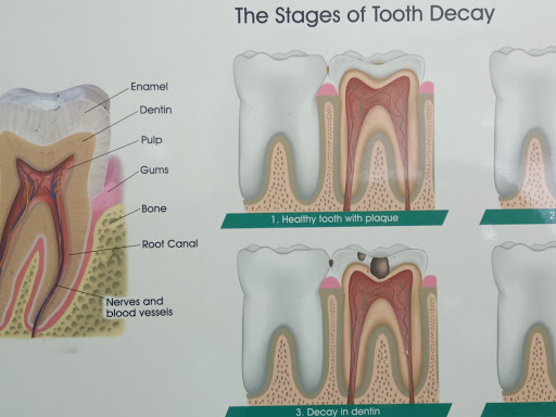 Get Your Tooth Back To Health post image