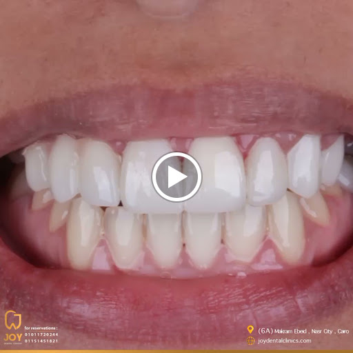 DentoShape Dental clinic Dr. Amgad Hassan Soliman د.أمجد حسن سليمان - صورة 6