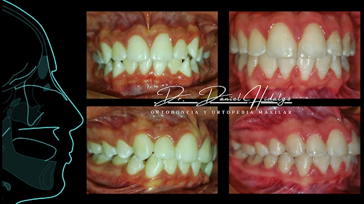 DH.Dental Atizapan C.D.E.O Daniel Hidalgo. - Thumbnail