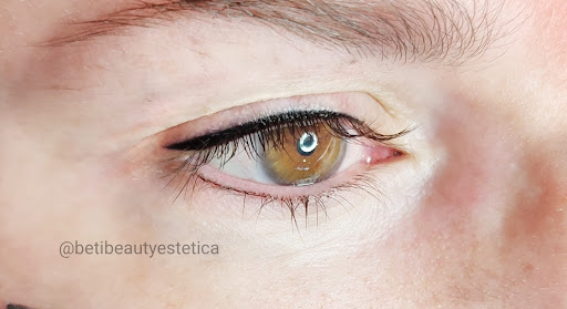 Beti Beauty estética - Thumbnail