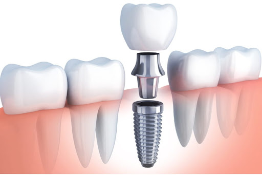 Gregory Dental Group - Thumbnail