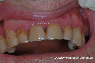 Photo n°6 de Laboratoire Stéphane REGIS à Le Robert (Centre de prothèses dentaires)