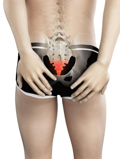 Tailbone pain (coccydynia) is soreness at the base of the spine that flares when sitting, leaning… post image