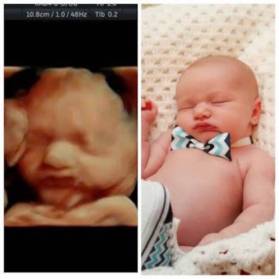 Photos of Baby Dimensions 2D 3D 4D and High Definition Ultrasounds of Your Baby!