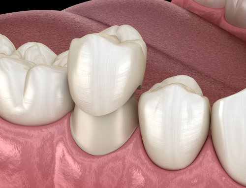 South River Dentistry - Thumbnail