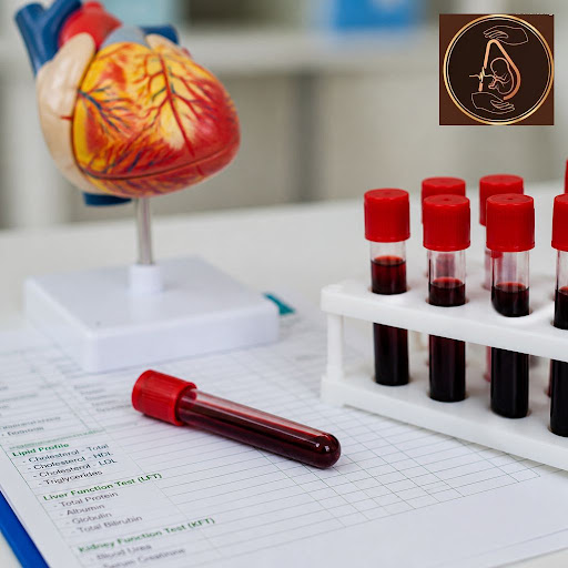 Take control of your heart health with accurate lipid profile screening at Ashwini Scan Centre in… post image
