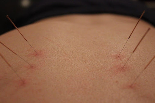 Positive Physio - Visual