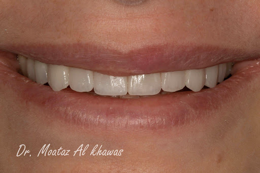 BE PLUS Dental Center - صورة 6