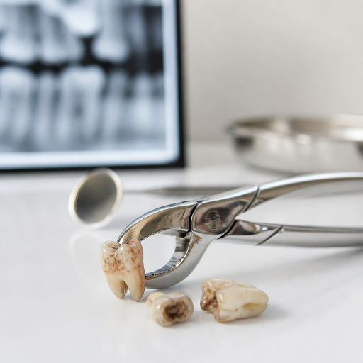 Not every painful tooth needs to be removed. Often, the right dentist in Kashipur can save your n… post image